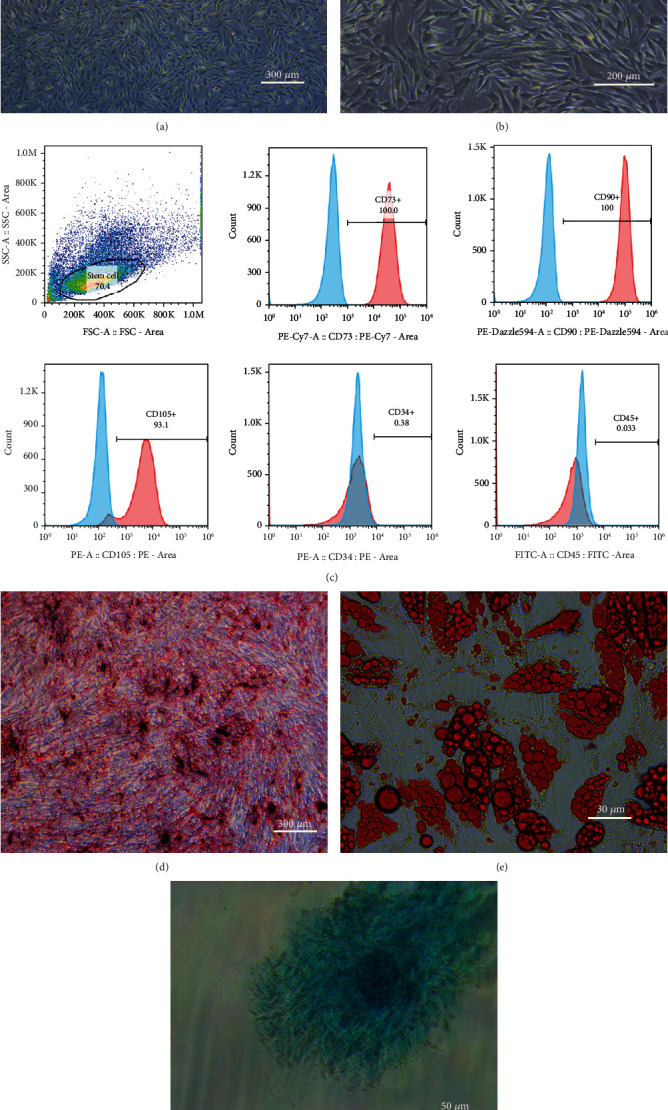 Characterization and identification of hADSCs. (a) Third-generation hADSCs (×40 magnification). (b) Third-generation hADSCs (×100 magnification). (c) Immunophenotypical analysis of hADSCs by flow cytometry. hADSCs were positive for CD73, CD90, and CD105 but negative for CD34 and CD45. (d) Alizarin Red staining showing calcium nodules (stained red). (e) Oil Red O staining showing lipid droplets (stained red). (f) Alcian blue staining showing the internal acid mucopolysaccharide in cartilage tissue (stained blue).