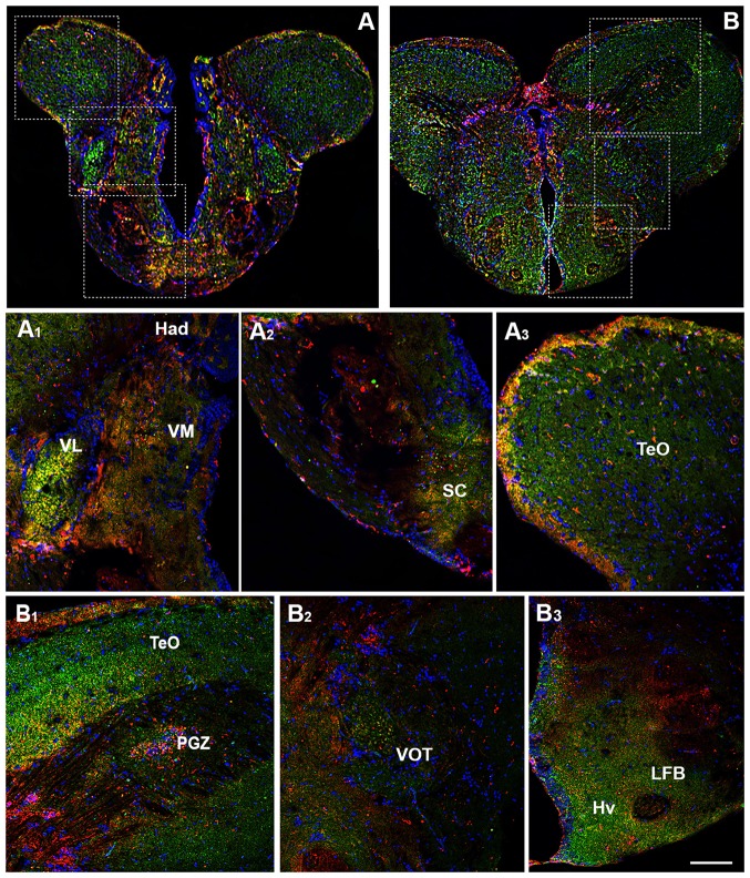 Distribution of OX-2R (red) and CB1R (green), and their co-localization OX-2R/CB1R (yellow) in coronal sections of the diencephalon. (A,B) OX-2R/CB1R co-expression has been observed in the suprachiasmatic nucleus (SC), ventrolateral (VL) and ventromedial (VM) thalamic nuclei, dorsal habenular nucleus (Had), optic tectum (TeO), periventricular gray zone of the optic tectum (PGZ), ventral optic tract (VOT), lateral forebrain bundle (LFB) and ventral zone of the periventricular hypothalamus (Hv). (A1–A3) Higher magnification of the fields boxed in (A) showing the OX-2R/CB1R co-expression within the Had, VL, VM (A1), SC (A2) and TeO (A3). (B1–B3) Higher magnification of the fields boxed in (B) showing the OX-2R/CB1R co-expression within the TeO, PGZ (B1), VOT (B2), LFB and Hv (B3). DAPI (Blue) was used as a counterstaining to show nuclei. Scale bar, 250 μm for (A,B); 50 μm for (A1–A3,B1–B3).