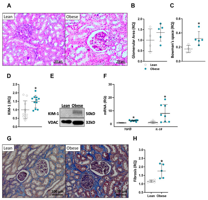 Kidney pathology of lean vs. obese individuals. (A) Representative images of ×20 magnified H&E-stained kidneys. Quantification of glomerular area (B) and Bowman’s space area (C). Kidney injury marker-1 (KIM-1) was measured via Western blot and quantified (D,E). TGFB and IL-18 relative kidney mRNA expression (F). Representative images of ×20 magnified Trichrome-stained kidney sections (G) and fibrosis quantification (H). Data are mean ± SD; * p < 0.05 obese vs. lean group.