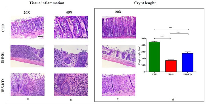 Hematoxylin and eosin staining of distal intestinal tract section from three experimental groups, control group (CTR, n° 12 animals), IBS rats fed a standard diet (IBS-St, n° 11 animals), and IBS rats treated with low-carbohydrate, high-fat ketogenic diet (IBS-KD, n° 17 animals). (a) Magnification 20× and (b) magnification 40×, scale bars 50 µm. (c) Magnification 20×, scale bar 50 µm, shows intestinal crypt length in the control group (CTR), IBS rats fed a standard diet (IBS-St), IBS rats treated with low-carbohydrate, high-fat ketogenic diet (IBS-KD). (d) Crypt length in the graph; results represent the mean ± SD (one-way ANOVA with Tukey’s multiple comparison test *** p < 0.0001).