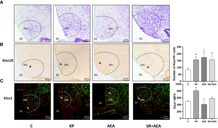 Expression and distribution of Kiss1R and Kiss1 proteins in the hypothalamic arcuate nucleus (ARC). Representative images (n = 4 for each animal group). Nissl staining showing ARC localization at ×20 magnification (A); IHC of Kiss1R expression modulation in ARC, ×20 magnification (B); IF analysis of the Kiss1 expression in ARC, ×40 magnification (C). C, control; KP, animals injected with Kp10; AEA, animals injected with AEA; SR + AEA, animals first received SR141716A and 30 min later received AEA treatment. 3V, third ventricle. **p< 0.01; *p< 0.05.