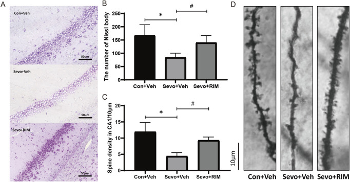Functions of maternal sevoflurane exposure in neuronal density and dendritic spine density in the hippocampal CA1 area of neonatal rats. Nissl staining under ×400 (A) and neuronal density ratio changes (B) in each group (n = 3). Golgi staining under ×1000 (D) and histograms of spine density/10 µm (C) in each group (n = 3). Data are displayed as mean ± S.E.M. **p < .01, vs. the Con + Veh group; #p < .05, ###p < .001, vs. the Sevo + Veh group.