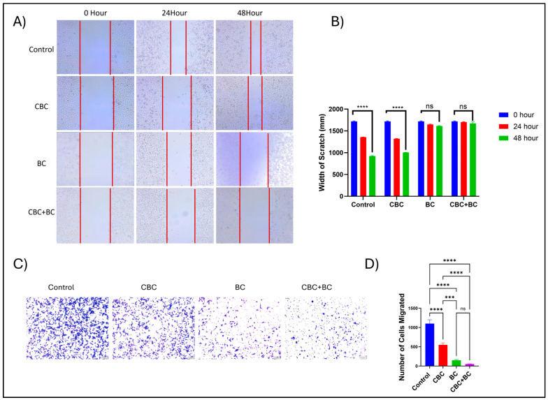 Effects of CBC, BC, and their combination on TNBC cell migration and invasion. (A) Insert-based wound healing assay showing the effects of CBC, BC, and their combination on cell migration. MDA-MB-231 Dox RT cells were seeded using inserts to generate a defined cell-free gap and treated with CBC, BC, and combination immediately after insert removal. Representative images were acquired at 0, 24, and 48 h. Scale bar = 100 µm. (B) Quantification of wound closure as the width of the scratch (mm) over time (mean ± SD, n = 3). The combination treatment significantly inhibited cell migration compared to individual treatments at 48 h. (C) Transwell invasion assay showing the effects of CBC, BC, and their combination on cell invasion. Cells were seeded in the upper chamber of Matrigel-coated transwells and treated with CBC, BC, or the combination. After 24 h, invaded cells were fixed, stained, and imaged. Scale bar = 100 µm. (D) Quantification of invaded cells (mean ± SD, n = 3) demonstrates a marked reduction in invasion with the combination treatment compared to single treatments. Statistical analyses were performed using one-way ANOVA followed by Tukey’s post hoc test (*** p < 0.001, **** p < 0.0001).