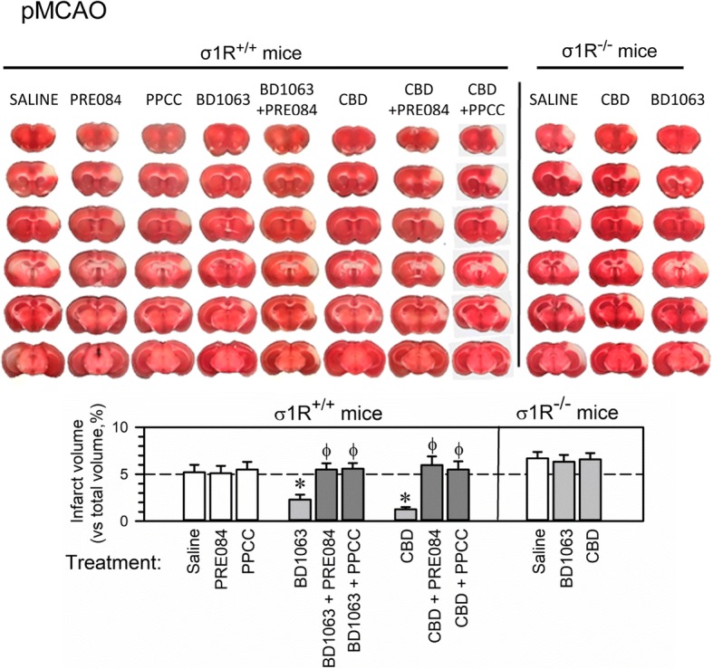 CBD administration diminishes ischemic brain damage in wild-type but not σ1R−/− mice. Upper panel, representative TTC-stained brain section images obtained from saline- and drug-treated mice (1 h after surgery) 48 h after pMCAO. White indicates infarction; red staining indicates normal tissue. Lower panel, the bar graphs quantitatively compare the infarct volume based on TTC staining from the wild type and σ1R−/− mice treated with saline, the σ1R agonists PRE084 and PPCC (white bars), or the σ1R antagonist BD1063 and CBD (gray bars) 1 h after surgery. The groups consisted of 8 to 10 mice, and the data are presented as the mean ± SEM. *Significantly different from the saline-treated mice. φ Significantly different from mice receiving only the σ1R antagonist BD1063 or CBD; ANOVA, Dunnett’s multiple comparison vs the corresponding control group, p < 0.05