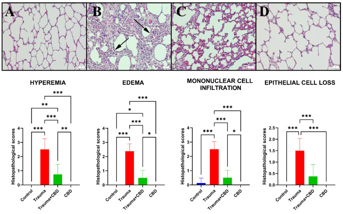 Histopathological view of lungs among the groups. (A) Normal lung histology in the Sham group. (B) Increased septal tissue thickness and inflammatory reactions (arrows) in the lungs of the Trauma group. (C) Decreased inflammatory reaction and septal tissue thickness in the Trauma + CBD group, (D) Normal tissue architecture in the CBD group, HE, scale bars = 50 μm. Statistical analysis of immunohistochemical values performed with One-way ANOVA (post-hoc Tukey). Values are presented as means ± SD. *p < 0.05 **p < 0.01 ***p < 0.001, Error bars represent standard deviation