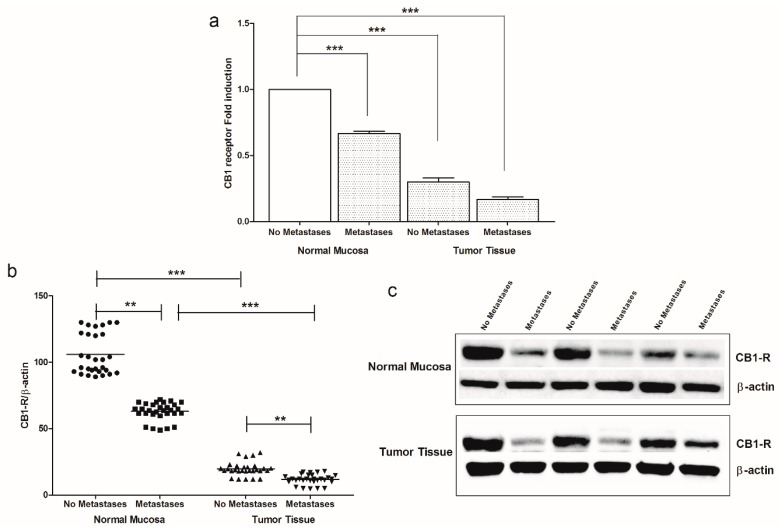 (a) CB1 receptor gene expression levels in intestinal tissue of no metastases (n = 29 patients) and with metastases patients (n = 30 patients) detected in both normal mucosa and tumor tissue. Data, expressed as mean value ± SD, are presented as fold induction compared to normal mucosa of patients without metastases. (b) Dot plots graph of CB1 receptor protein values detected in our patients groups. ** p < 0.02, *** p < 0.001 indicate statistically significant differences (one-way analysis of variance with Dunnett’s and Tukey’s multiple comparison test, where appropriate). (c) Representative Western blot bands of CB1-R and β-actin proteins. All Western blot figures include a dot plots graph showing the densitometry values of each sample (band) normalized to β-actin value. The whole blot has been provided as Supplemental Materials (Figure S1).