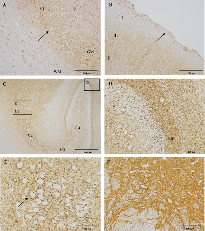 CB1 immunostaining of the cerebral cortex, hippocampus and substantia nigra in a six-month-old Beagle dog.Within the frontal lobe of the cerebral cortex, there is an intense CB1 immunoreactivity of fibres surrounding unstained neuronal bodies in layers V and VI (A; arrow). In figure B, layer I appears almost devoid of CB1 immunoreactivity and layer II and III express strong immunoreactivity. Notice that the meninges show positive flattened fibroblast-like cells in the dura matter (B, arrow). The hippocampus shows progressive decrease in the immunoreactivity from C1 to C4 (C). In figure D, the dentate gyrus of the hippocampus depicting strong dot-like CB1 immunoreactivity in the molecular layer (ML). Interestingly, the granule cell layer (GCL) appears devoid of CB1 immunoreactivity. The stratum pyramidale shows strong CB1 immunoreactive fibres surrounding unstained pyramidal neuronal bodies in the C1 (E; arrow). In figure F, strong CB1 immunoreactivity is observed in fibres of the substantia nigra pars reticulata. IHC was performed using the avidin-biotin-peroxidase complex (ABC) method. WM: white matter; GM: grey matter.