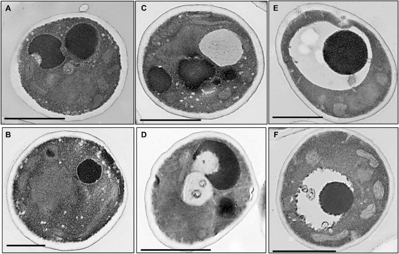 Transmission electron microscopy (TEM) of C. auris cells treated with Tavaborole and AmB; (A-B) untreated control C. auris, (C-D) candida cells treated with Tavaborole and, (E-F) C. auris treated with AmB. Scale bar = 1 μm.