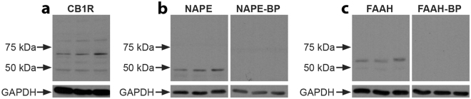 Presence of CB1R, NAPE-PLD, or FAAH in the NAc of three vervet monkeys. WB analysis of total protein samples for the CB1R antibody (a) showing detection of the expected major protein band at 60 kDa. For the NAPE-PLD antibody (b), the expected band is seen at 46 kDa, and not detected when pre-incubated with its blocking peptide. For the FAAH antibody (c), the expected band is seen at 63 kDa, and not detected when pre-incubated with its blocking peptide. All lanes contained 10 µg of total protein. The lower blots show the expression of GAPDH and demonstrate loading in all lanes.