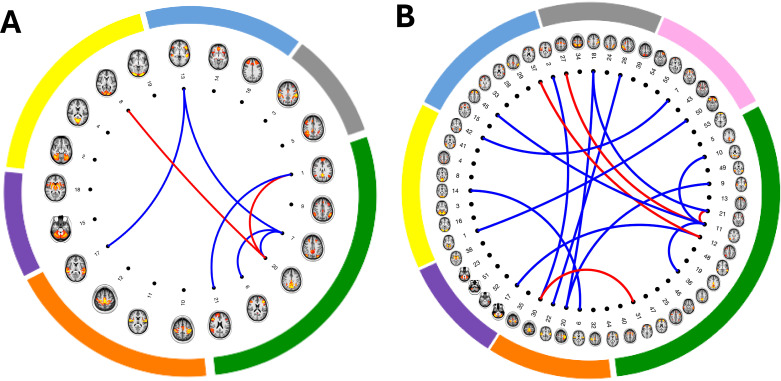 Resting state functional connectivity significantly associated with cannabis use. Spatial maps of resting state network nodes (n=21 and n=55) are illustrated in brain images. These were identified as non-noise components from: (A) 25-component group-independent component analysis proposed by Miller et al.13 Nodes are grouped by networks as follows: default mode/central executive network (green), motor network (orange) subcortical-cerebellum network (purple), visual network (yellow), salience/default mode/central executive network (blue) and attention/default mode/central executive network (grey). (B) 100-component group-independent component analysis. Nodes are grouped by networks as follows: default mode/central executive network (green), motor/attention network (orange) subcortical-cerebellum network (purple), visual/attention network (yellow), salience/default mode/central executive network (blue), attention/salience/central executive network (grey) and limbic/default mode network (pink). Connecting lines indicate partial correlations between network nodes significantly associated with cannabis (red lines indicate stronger connectivity and blue lines indicate weaker connectivity).