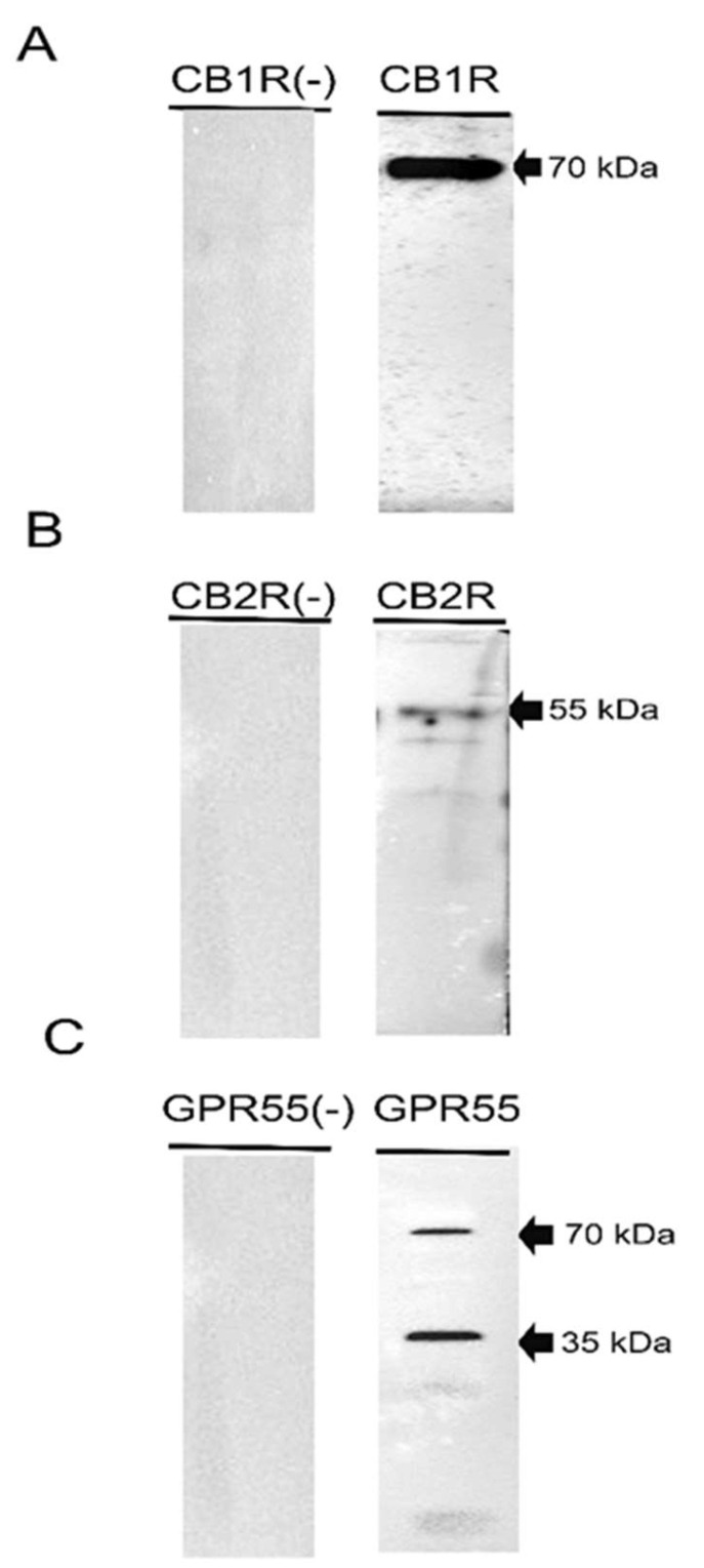 Representative image of Western blot analysis showing the specificity of the primary antibodies utilised (right panel): rabbit anti-cannabinoid receptor 1 (A), mouse anti-cannabinoid receptor 2 (B), and rabbit anti-G protein-coupled receptor 55 (GPR55) (C). Negative controls, in which the primary antibodies were not involved in the incubation with the membrane, did not show bands (left panel).