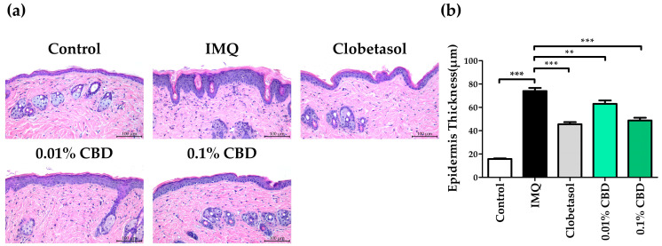 Comparison of epidermal thickness and H and E staining in a psoriasis mouse model treated with CBD. (a) Representative images of H and E staining of mouse dorsal skin. (b) Epidermal thickness change in each group. Data are presented as mean ± SEM values. ** p < 0.01 and *** p < 0.001 compared to the Control group or IMQ group. CBD, cannabidiol; H and E, hematoxylin and eosin; IMQ, imiquimod; SEM, standard error of the mean.