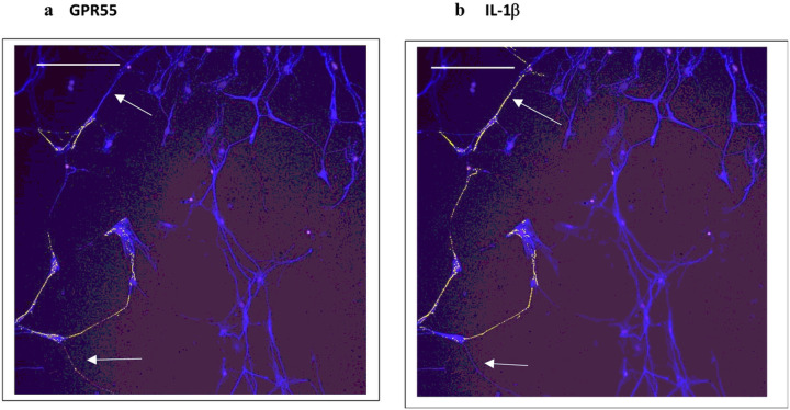Immunofluorescent images of the same field from dorsal root ganglion cultures comparing GPR55 (a) and IL-1b(b): evidence for slight differences in distribution of GPR55 and IL1b within the same neurons Day 9 DRG neurons were identified with antibodies to beta-3 tubulin. Arrows are pointing to differences in the labeling pattern between GPR55 and IL-1b. The calibration bar = 150 m.