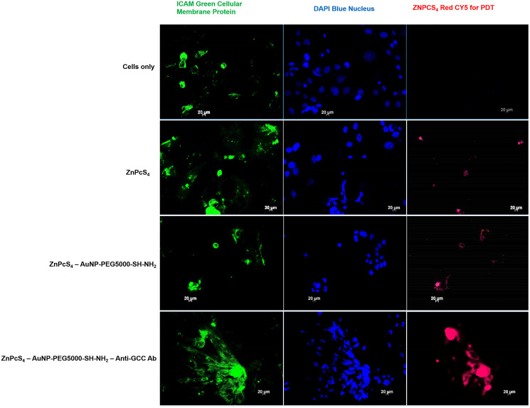 Subcellular localization comparison of ZnPcS4 PS uptake in CaCo-2 cells, treated with ZnPcS4 PS alone, PS-AuNP and FNBC after 24 h of incubation.Images in the first column show ICAM-stained cellular membrane proteins (Green), images in the second column show DAPI-stained nuclei (Blue) and images in the third column show ZnPcS4 red fluorescence (RED).