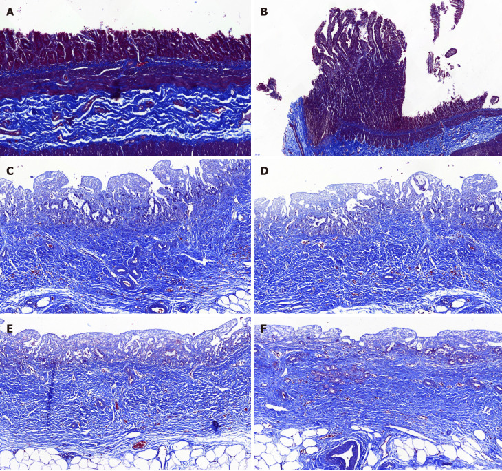 Masson’s trichrome staining. The Masson’s trichrome staining showed marked regeneration of the submucosal connective tissue and no significant differences between the animal-derived artificial bile duct site and the normal bile duct. The submucosal connective tissue was more regular and thicker in group B than that in group A. A: Masson staining of the animal-derived artificial bile duct site in group A (magnification: 20 ×); B: Masson staining of duodenal papilla in group A (magnification: 20 ×); C and D: Masson staining of the animal-derived artificial bile duct site in group B (magnification: 20 ×); E and F: Masson staining of the distal normal bile duct in group B (magnification: 20 ×).