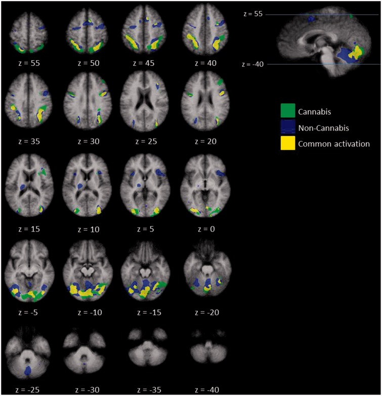Within-group activations of the SDMT >Rest contrast using a Bonferroni correction.SDMT: Symbol Digit Modalities Test; Rest: resting state.