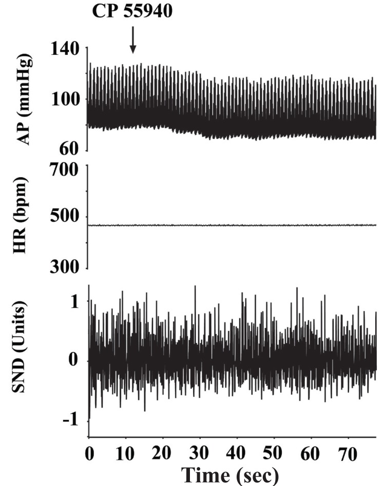 Sinoaortic denervation attenuates the actions of cannabinoid agonist CP 55940. Arterial pressure (AP) and heart rate (HR) are expressed in mmHg and in beats per min (bpm), respectively. Sympathetic nerve discharge (SND) is expressed in arbitrary units.
