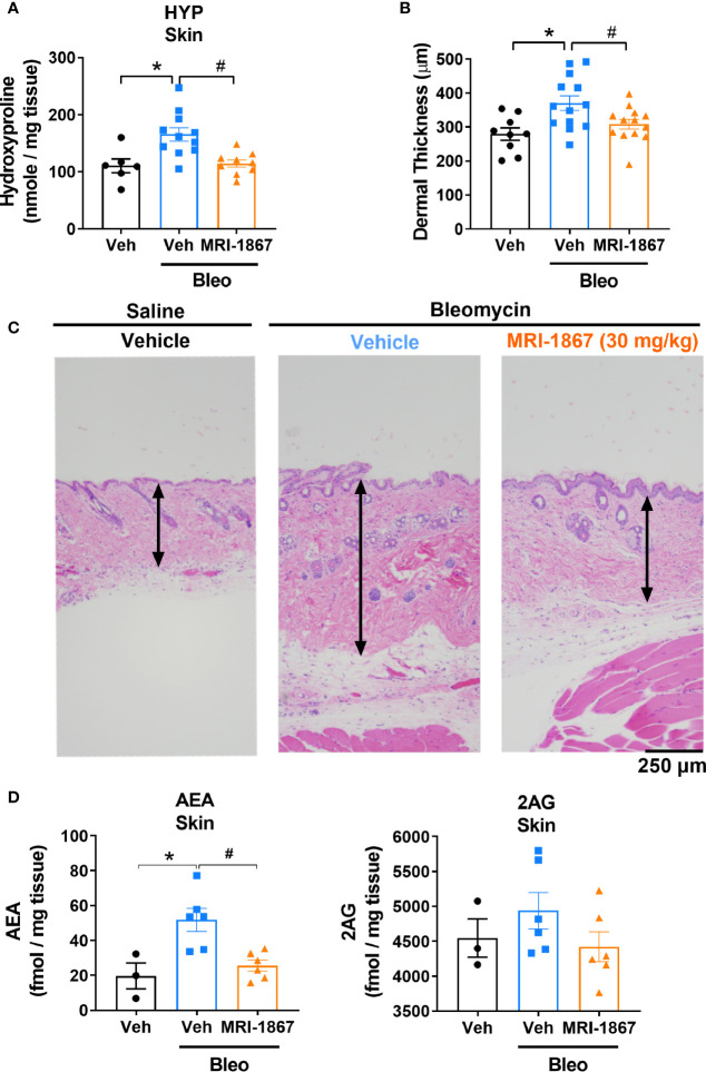 MRI-1867 (30 mg/kg) attenuates bleomycin-induced fibrosis and dermal thickness in Mdr1a/b(−/−) -Bcrp(-/-) mice. (A) Hydroxyproline levels in biopsied skin. (B) Dermal thickness analyses from skin biopsies. (C) Representative histological images from skin biopsies stained with H&E. (D) AEA and 2AG levels in biopsied skin. Six mm skin biopsies are used for the analysis. Dermal thickness assessed from left scapular injection site biopsies, Hydroxyproline and endocannabinoid measurements performed using right scapular injection site biopsies from each mouse. Data represent means ± SEM from 3-13 mice per group. Data were analyzed by 1-way ANOVA followed by Dunnett’s multiple comparisons test. Significant difference from corresponding values in control (saline and vehicle treated group) (*P < 0.05) or from values in bleomycin and vehicle-treated group (#P < 0.05).