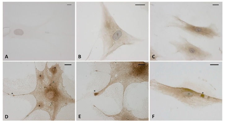 Immunostaining with hyaluronic acid binding protein (HABP) (dilution 1:1000, Merck Millipore). (A) Negative control with omission of HABP incubation. (B,C) control cells. (D–F) treated cells with HU-308 2.5 µM (4 h). The treated samples clearly shows HA-rich vesicles, in both the cytoplasmic region and the cytoplasmic extensions (*). Nuclei counterstained with hematoxylin. Scale bars: 10 µm.