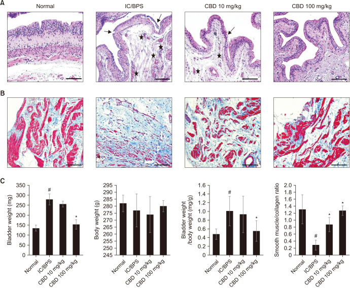 (A) Representative images of bladder tissue stained with hematoxylin and eosin (H&E), showing the Normal control group, IC/BPS group, CBD 10 mg/kg treatment group, and CBD 100 mg/kg treatment group. The IC/BPS group exhibited severe urothelial ulceration (arrows), marked edema, and lamina propria congestion (stars) compared to the Normal control group. In the CBD 10 mg/kg group, mild urothelial ulceration (arrows), mild lamina propria congestion (stars), and slight edema were observed. The CBD 100 mg/kg group showed nearly normal urothelium, submucosal lamina propria, and muscularis propria (scale bar=100 µm); (B) Masson’s trichrome staining of bladder tissue revealed reduced fibrosis in the CBD-treated groups (scale bar=200 µm); (C) Bladder weight, body weight, bladder-to-body weight ratio, and muscle-to-collagen ratio in each group. Data are expressed as mean±standard deviation. IC/BPS: interstitial cystitis/bladder pain syndrome, CBD: cannabidiol. *p<0.05 compared with the IC/BPS group; #p<0.05 compared with the control group.