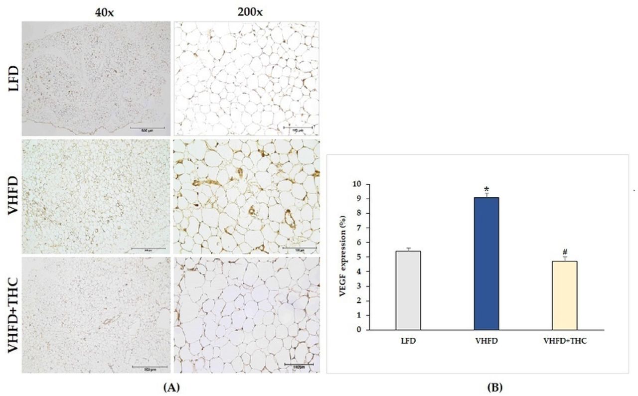 Effect of THC on VEGF expression in VHFD-induced obese mice:(A) Representative VEGF expression; left column, magnification 40×; scale bar = 500 μm; right column, magnification 200×; scale bar = 100 μm; (B) %VEGF expression. Data are presented as mean ± SEM. *p < 0.001 vs. LFD group; #p < 0.001 vs. VHFD group.