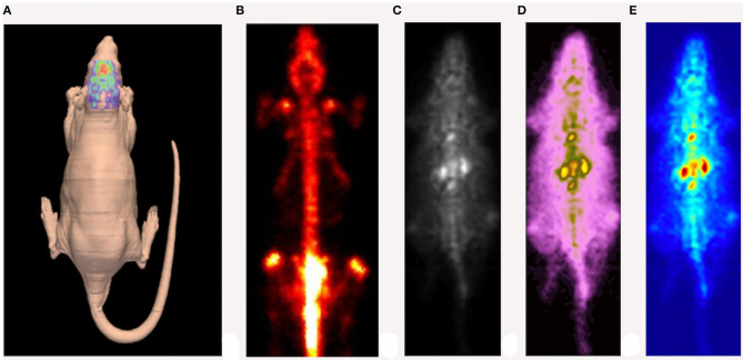 Example of high-resolution SPECT image of a rat injected with [123I] DATSCAN. (A) Reconstruction of the animal's skin carried out by a laser scanner. (B) SPECT image obtained 24 h after the injection. (C–E) Early SPECT image obtained ~1 h after the injection (different color maps).