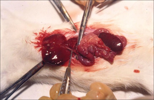 Photograph showing the liver, common bile duct, and duodenal loop; pointer showing the common bile duct