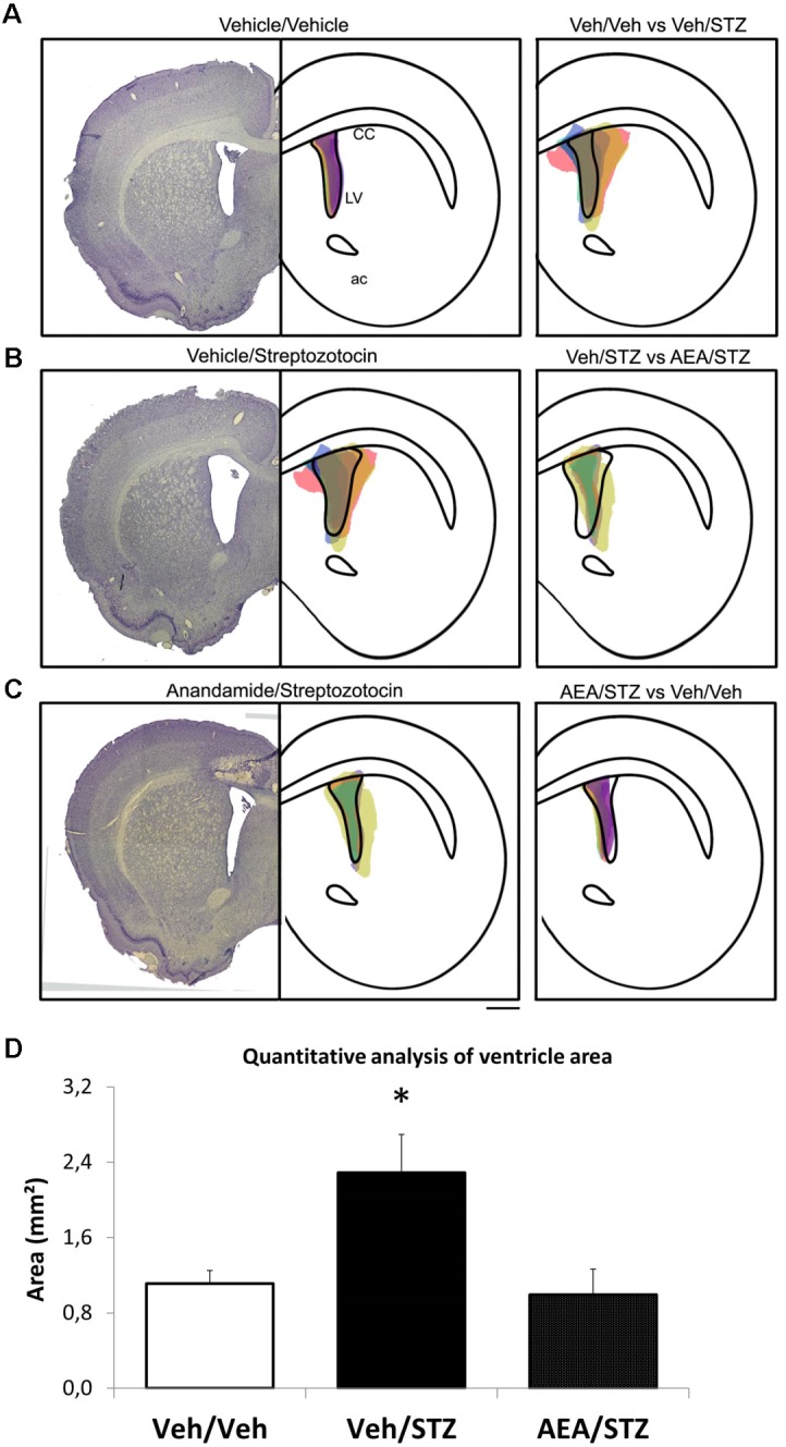 Schematic representation and quantitative analysis of the cerebral ventricular area of Veh/Veh, Veh/STZ, and AEA/STZ animals. The left panel presents a representative histologic image of the lateral ventricle (LV) of the Veh/Veh groups in (A), Veh/STZ in (B), and AEA/STZ in (C). The central panel represents schematically the shape of the histological figure from left, filled with colored spots corresponding to the ventricular area of each of the samples used in the respective groups (n = 3–5). The right panel represents the central figure with the shape of the ventricle of one group overlapped with the ventricular area of the samples from another group (A: Veh/Veh × Veh/STZ, B: Veh/STZ × AEA/STZ and C: AEA/STZ × Veh/Veh). (D) shows the quantitative analysis of ventricle area (mm2), measured + 1.56 mm (anteroposterior) from bregma. ∗p < 0.05, area values are different from Veh/Veh and AEA/STZ (one-way ANOVA, followed by Duncan’s post-test).