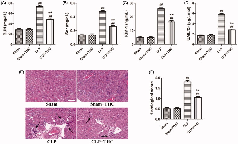 THC improved the kidney function and ameliorated renal histological damage in septic mice. (A) The serum level of BUN. (B) The serum level of Cr. (C) The urine level of KIM-1. (D) The urine level of UAlb/Cr. (E) Representative images of HE staining of renal histological changes (black arrow: glomerulus degeneration and necrosis, white arrow: renal tubules edema) (magnification ×400, scale bar = 50 μm). (F) Histological score. Data were presented as the mean ± SEM (n = 6 in each group). ##p< .01 vs. the Sham group, **p< .01 vs. the CLP group.
