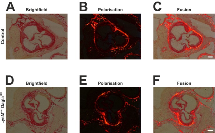 Collagen structures within the atherosclerotic aortic sinus.Frozen sections of both control mice and Dagla-deficient mice were stained using haematoxylin and direct red to visualise collagen structures. Microphotographic pictures were taken using bright field microscopy (A, D), polarisation microscopy (B, E), or a combination of both (C, F). No differences were seen in amount and distribution of collagen fibers between control mice (A-C) and Dagla-deficient mice (D-F). Scale bar, 200 μm. Cre, cyclisation recombination; Dagla, diacylglycerol lipase α; fl, flanked by loxP.