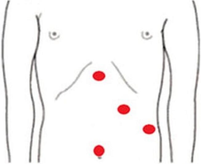 Fig. 9