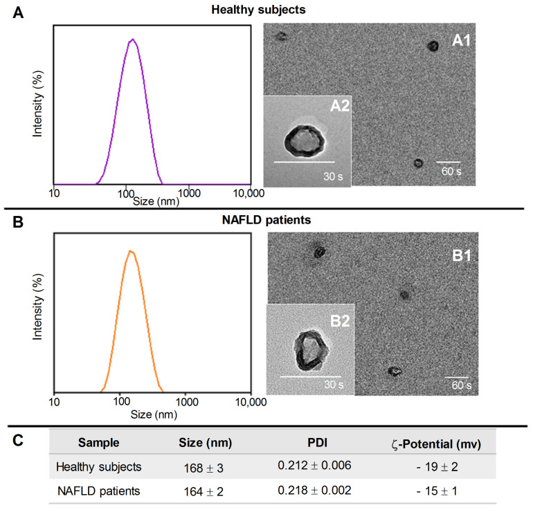 Representative DLS-intensity distribution and TEM micrographs (scale bar 200 nm) of exosomes isolated from healthy subjects (Panel A) and NAFLD patients (Panel B) at two different staining times, 30 s (A2 and B2) and 60 s (A1 and B1). (Panel C), the average hydrodynamic diameter and polydispersity index (PDI) obtained by DLS analysis and ζ-potential value of the exosomes (mean ± SD).