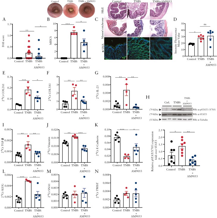 N-acylethanolamine acid amidase (NAAA) inhibition ameliorates murine intestinal fibrosis. (A) Disease Activity Index (DAI) score of control mice, 2,4,6-trinitrobenzensulfonic acid (TNBS)-treated mice, and TNBS-treated mice with NAAA inhibitor AM9053 (20 mg/kg/i.p.). DAI score was measured every 2 days. DAI was assessed considering stool consistency and presence of blood. Error bars represent mean ± SEM; *p ≤ 0.05 and **p ≤ 0.01 as calculated by 1-way analysis of variance (ANOVA) followed by Dunnett’s post hoc test. (B) Murine Endoscopic Index of Colitis Severity (MEICS) in control mice, TNBS-treated mice, and TNBS-treated mice with NAAA inhibitor AM9053 (20 mg/kg/i.p.). Error bars represent mean ± SEM of n = 4-5 mice per experimental group; *p ≤ 0.05 and ***p ≤ 0.001 as calculated by 1-way ANOVA followed by Dunnett’s post hoc test. Representative colonoscopy images, carried out at the day of sacrifice, of control mice, TNBS-treated mice, and TNBS-treated mice with the NAAA inhibitor AM9053 (20 mg/kg/i.p.) are reported at the top of the graph. (C) Representative images for hematotoxilin & eosin (H&E) stain (10×) (upper images), Masson’s trichrome stain for collagen fiber deposition in which the blue color indicates collagen fibers (10×) (middle images), and confocal images of α-SMA/DAPI, in which the green color represents α-SMA and the blue the nuclei staining (20×) (lower images) in control mice, TNBS-treated mice, and TNBS-treated mice with the NAAA inhibitor AM9053 (20 mg/kg/i.p.). (D) Quantification of intensity fluorescence mean values of α-SMA signals. Error bars represent mean ± SEM of n = 4-5 mice per experimental group; *p ≤ 0.05 assessed by 1-way ANOVA followed by Dunnett’s multiple comparisons. (E-N) Gene expression associated with intestinal fibrosis and epithelial-to-mesenchymal transition, namely COL2A1 (E), COL3A1 (F), IL-23 (G), TGF-β (I), Vimentin (J), E-cadherin (K), Slug (L), SNA1 (M), and TWIST (N), evaluated by RT-qPCR in intestinal specimens of control mice, TNBS-treated mice, and TNBS-treated mice with NAAA inhibitor AM9053 (20 mg/kg/i.p.). Results are calculated using the 2-ΔCt formula. Error bars represent mean ± SEM of n = 4-5 mice per experimental group. *p ≤ 0.05, **p ≤ 0.01, and ***p ≤ 0.001 as calculated by 1-way ANOVA followed by Dunnett’s post hoc test. (H) pSTAT3(Y705) protein expression by western blot analysis in intestinal specimens of control mice, TNBS-treated mice, and TNBS-treated mice with NAAA inhibitor AM9053 (20 mg/kg/i.p.) and normalized on total STAT3 and/or tubulin. Representative immunoblots are reported on top of the graph. Data are presented as means ± SEM of n = 7 independent samples. *p ≤ 0.05 and**p ≤ 0.01 as assessed by 1-way ANOVA followed by Dunnett’s multiple comparisons.