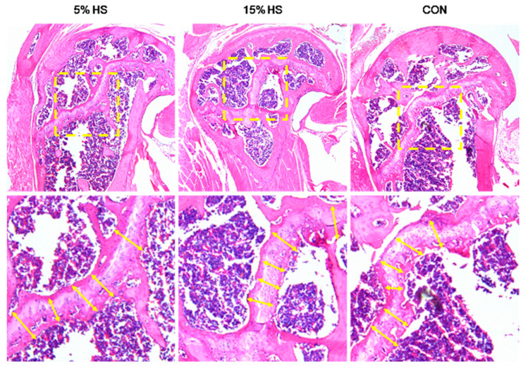 H&E-stained sections of the humerus distal epiphyseal plate from mice representing the three treatment groups (5% HS, 15% HS and control). Top row: Yellow dashed line boxes show the region of interest. Bottom row: Yellow arrows indicate the positioning of markers of measurements of growth plate thickness. For each image, only 5–6 markers (of 20 total per sample) are shown to better visualize the growth plate.
