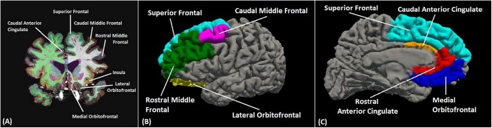 Sample FreeSurfer segmented image.Coronal (A), lateral (B) and medial (C) image showing typical automated cortical segmentation results from FreeSurfer. Different brain regions are indicated by different colors. Visible sub regions used in this study are labeled.