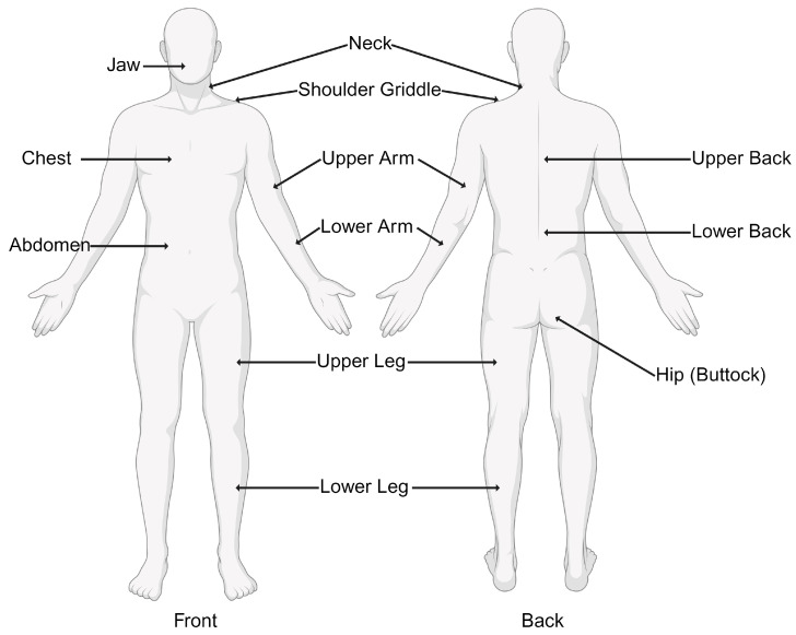 Nineteen tender points used by the Widespread Pain Index (WPI) in the diagnosis of fibromyalgia.