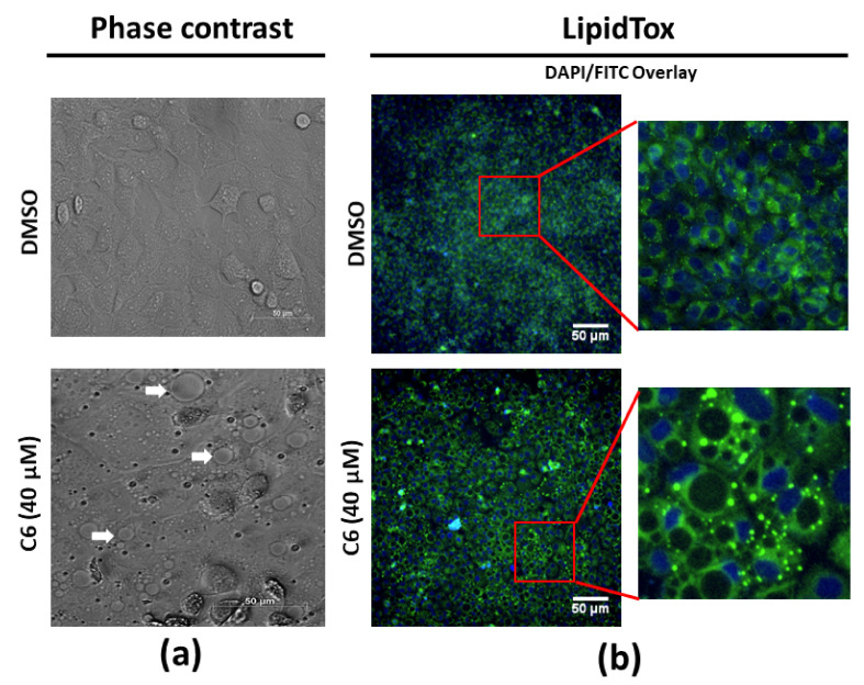 Evaluating lipid droplet accumulation in the MCF-7 cell line. (a) Morphological changes induced by C6 observed with phase contrast micrographs; white arrows indicate structures of interest. (b) Typical micrographs obtained for MCF-7 cells stained with HCS LipidTOXTM Green neutral lipid stain after treatment with C6.