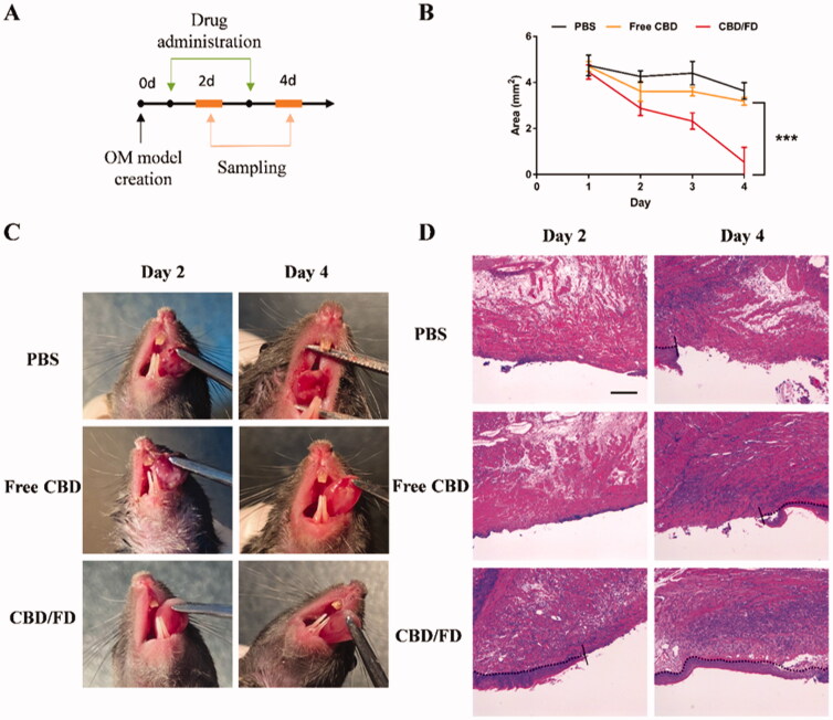 The therapeutic effect of CBD/FD nanomicelles on tongue ulcers after intravenous administration. (A) Drug administration and sampling. (B) Change in the ulcer area over time (n = 5). Data are shown as mean ± SD. (C) Tongue ulcer images at 2 and 4 days post-administration. (D) Hematoxylin and eosin images of tongue ulcers. Solid lines indicate the ulcer boundary, and dotted lines indicate the epithelial-stromal boundary. Scale bar, 100 μm.