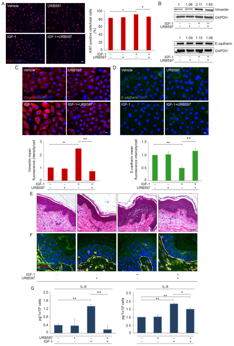 URB597 contrasts the EMT phenotype induced by IGF-1 by reducing vimentin expression, modulating E-cadherin localization, and decreasing the release of pro-inflammatory cytokines. (A) Immunofluorescence and quantitative analysis of Ki67 stained NHKs following IGF-1 (100 ng/mL) stimulation for 48 h in the presence or absence of URB597 (1 μM). Results are expressed as the mean value ± SD of positive cells/total cells (%). Scale bar: 20 μm. (B) Western blot of vimentin and E-cadherin on NHKs in response to IGF-1 and URB597. Representative blots are shown. GAPDH was used as an endogenous loading control. Densitometric scanning of band intensities was performed to quantify the change in protein expression. Results are expressed as fold change ± SD relative to vehicle-treated cell value, which was set as 1-fold in each case. Immunofluorescence and signal intensity measurement of vimentin (C) and E-cadherin (D) in NHKs treated as above. Nuclei are counterstained in DAPI. Scale bar: 10 μm. Data are representative of three independent experiments. (E) Hematoxylin-and-eosin-stained sections and (F) immunofluorescence for E-cadherin and vimentin proteins from ex vivo skin explants stimulated with IGF-1 in the presence or absence of URB597 (5 μM). Nuclei in (F) are counterstained with DAPI and the basal membrane is outlined with a white dashed line. Scale bar: 50 μm (E), 20 μm (F). (G) IL-6 and IL-8 quantitation by ELISA in URB597- and vehicle-treated cells following IGF-1 stimulation for 48 h. * p < 0.05 vs. vehicle-treated cells; ** p < 0.01 vs. vehicle-treated cells; # p < 0.05 vs. IGF-1-treated cells; ## p < 0.01 vs. IGF-1-treated cells.