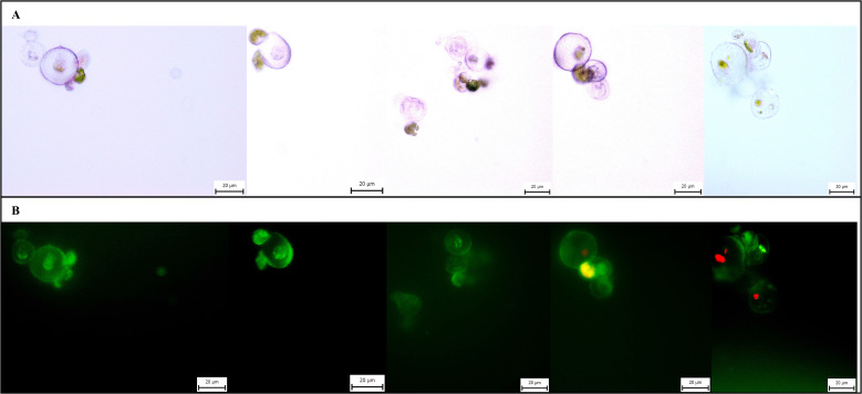 Microphotographs of microcalli of C. sativa ‘USO 31’. Cultivated for 14 days, stained with FDA, magnification 40×. (A) Observation under transmitted light. (B) Observation under broad-spectrum UV light.
