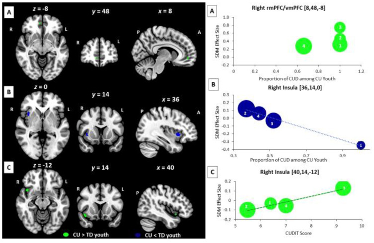 Meta-regression Results Showing an Association Between the Proportion of Cannabis Using Youth with Cannabis Use Disorder diagnoses and BOLD response during executive control (A) and reward processing (B) and an Association Between Mean CUDIT scores of Cannabis Using Youth and BOLD response during social cognition/emotion processing (C). Associations between the proportion of CUD diagnoses among CU youth and BOLD response differences in the rostral and ventral medial prefrontal cortex (CU > TD: rmPFC/vmPFC, 11 voxels, SDM-Z = 2.83) during executive control (A) are shown in green and in the right insula (CU < TD: Ins, 38 voxels, SDM-Z = −3.21) during reward processing (B) are shown in blue. Associations between mean CUDIT score among CU youth and BOLD response differences in right insula (CU > TD: Ins, 44 voxels, SDM-Z = 2.93) during social cognition and emotion processing (C) are shown in green. All results are thresholded at p < 0.005. Images visualized using MRIcroGL and presented on SDM template. Labeled meta-regression plots are presented to the right of each corresponding image (A–C). Effect sizes (SDM-estimates) used to create the meta-regression plots were extracted from the peak of maximum slope significance. The meta-regression SDM-estimate value is derived from the proportion of studies that reported BOLD signal changes near the voxel so it is expected that some values are at 0 or near +/− 1. Each included study is represented as a numbered dot, with the dot size reflecting relative total sample size of each specific study in comparison to the average total sample size of all studies included in the regression. For (A) the regression is plotted but the line is not shown as all but one study included in that analysis had a CUD proportion of 1.0. As this meta-regression result was driven by three studies (Schweinsberg et al., 2005, Behan et al., 2014, and Cyr et al., 2019) for which all CU participants met the criteria for CUD, this meta-regression analysis was rerun as a subgroup meta-analysis restricted to these 3 studies. The results of this analysis (detailed in Section 3.5) showed the same rmPFC/vmPFC cluster. Study key for 3A: 1 = Behan et al., 2014; 2 = Cyr et al., 2019; 3 = Schweinsburg et al., 2005; 4 = Schweinsburg et al., 2011. Study key for 3B: 1 = DeBellis et al., 2013; 2 = Aloi et al., 2019; 3 = Aloi et al., 2020; 4 = Aloi et al., 2021b. Study key for 3C: 1 = Blair et al., 2019; 2 = Leiker et al., 2019; 3 = Blair et al., 2021; 4 = Aloi et al., 2018. Abbreviations: A = anterior; P = posterior; L = left; R = right; rmPFC = rostral medial prefrontal cortex; CU = Cannabis Use; TD = Typically Developing; CUD = Cannabis Use Disorder; CUDIT = Cannabis Use Disorder Identification Test.