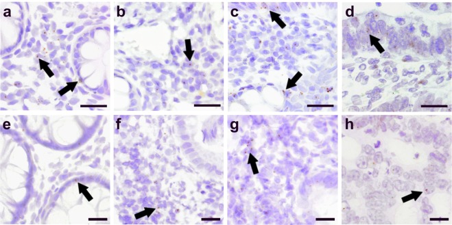 Localization of receptors of GPR55 and CB2 in IBD and CRC patients. ISH staining of GPR55 mRNA (a–d) and CB2 mRNA (e–h) in colonic mucosal biopsies of control subjects (a,e), patients with Crohn’s disease (CD) (b,f), ulcerative colitis (UC) (c,g), and colorectal cancer (CRC) (d,h). Images are representative for three individuals/cohort. Arrows point at representative DAB staining of GPR55 and CB2 mRNA. Calibration bars: 50 µm (a–d); 20 µm (e–h).