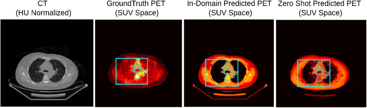 Qualitative comparison of CT input, ground-truth PET, in-domain predicted PET, and zero-shot predicted PET in SUV space. Cyan bounding box highlights focal metabolic region.