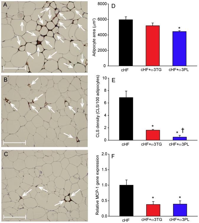 Reversal of adipose tissue hypertrophy and low-grade inflammation by dietary LC n-3 PUFA.Following a 4-month period of cHF-feeding, mice were fed for additional 9 weeks with cHF diet or treated using either cHF+ω3TG or cHF+ω3PL diet supplemented with 30 g DHA/EPA per kg; all diets also contained 2 g metformin per kg. Hematoxyline-eosin staining of epididymal fat sections from mice fed cHF (A), cHF+ω3TG (B), or cHF+ω3PL (C) diet. D Adipocyte size; morphometric analysis was based on more than 1,000 cells taken randomly from 5 different areas per animal (n = 3). E Amount of MAC-2 immunoreactive macrophages in the above tissue sections, expressed as the number of crown-like structures (CLS; indicated by white arrows in A–C). F Adipose tissue gene expression of monocyte chemoattractant protein-1 (MCP-1), a chemokine which is involved in the recruitment of monocytes to sites of injury and infection. cHF diet, black bars; cHF+ω3TG diet, red bars; cHF+ω3PL diet; blue bars. A-C, Scale bars = 200 µm. Data are means±SEM (n = 7−8; D–F). *Significantly different from cHF; †significantly different from cHF+ω3TG (all analyses by ANOVA).