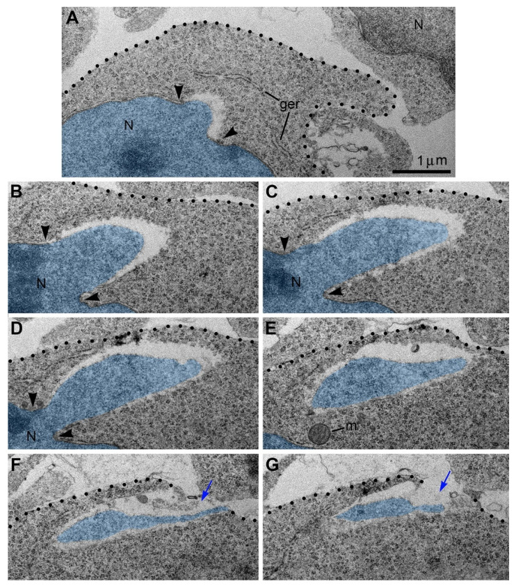 Serial micrographs of PNH in a neuron from the cerebral intermediate zone of an embryo exposed to CB1R agonist WIN-55,212-2 show continuum of the chromatin stream expelled from the nucleus (highlighted blue) and penetrating the intercellular space. Points of NE interruption in (A–D) are indicated with arrowheads. Volume of the herniated chromatin stream was estimated in the complete series of 31 sections as 1.63 µm3. Blue arrows in (F,G) denote the interruption of the plasma membranes, which are designated with dotted lines. Scale bar in (A) is valid for all. Abbreviations: ger, granular endoplasmic reticulum; m, mitochondrion; N, nucleus. Modified from [53]. (License CC BY).