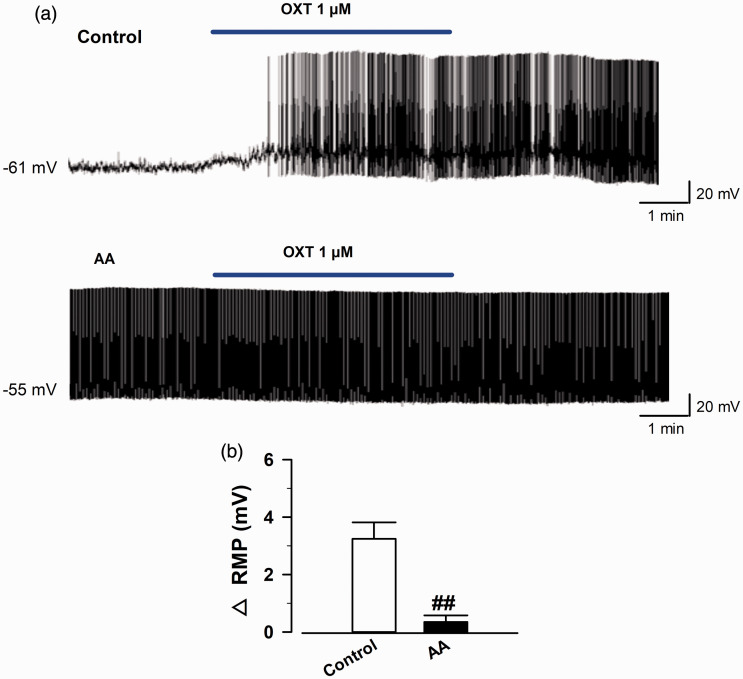 Effect of bath application of OXT on RMPs in OXT-mRFP1 neurons in slices from control and AA rats. (a) Example RMPs traces in the OXT-mRFP1 neurons in slices from control (top) and AA (bottom) rats. (b) Summary RMPs change data of OXT (1 μM) in control and AA rats (control group, n = 9 neurons/5 rats, AA group, n = 8 neurons/5 rats) ##p < 0.01 compared with baseline. AA: adjuvant arthritis; RMP: resting membrane potential; OXT: oxytocin.