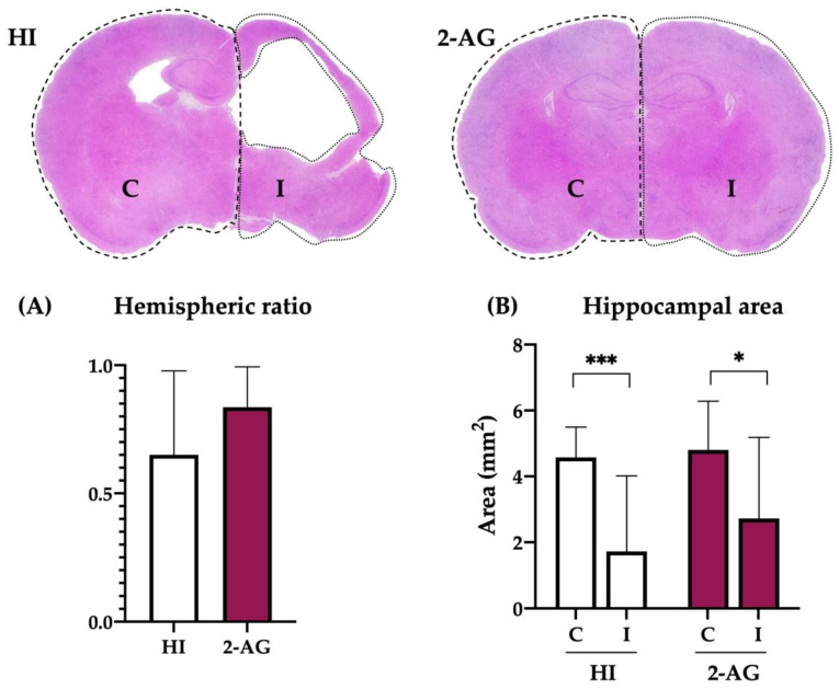 Long-term effect of 2-AG administration in hemispheric ratio values and hippocampal areas at P90. (A) The hemispheric ratios of HI animals were lower than those from 2-AG-treated pups, although differences were not statistically significant. (B) In the hippocampal area study, contralateral and ipsilateral sides showed significant differences within each group (HI *** p < 0.001; 2-AG * p < 0.05), but inter-group comparison showed no significant differences.