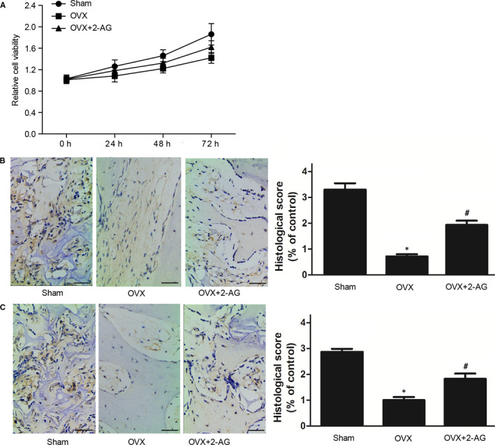 Effect of 2‐AG on the proliferation and differentiation of hBMSCs was determined using MTT assay. (A) Proliferation in sham and OVX + 2‐AG groups was much higher than that in the OVX group. (B) Collagen type I level in OVX and OVX + 2‐AG groups was much lower than that in the sham group, and collagen type I level in the OVX group was even lower. (C) ALP level in OVX and OVX + 2‐AG groups was much lower than that in the sham group, and ALP level in OVX group was even lower