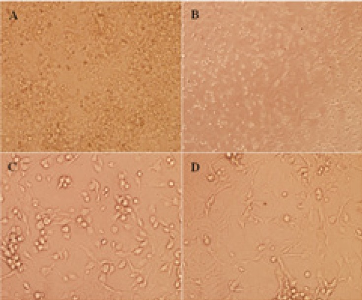 The dissociated cerebellar granular cells (CGNs) from cerebellum of postnatal 7-day-old Wistar rat pups. CGNs after 24 h seeded in 12-well culture plate were presented with × 100 magnification (A). CGNs after 24 h following cytosine arabinoside (Ara-C) added with × 100 (B) and × 400 magnification (C), respectively, using light microscope were indicated. CGNs at day 5 which all pharmacological interventions were started were presented with × 400 magnification (D).