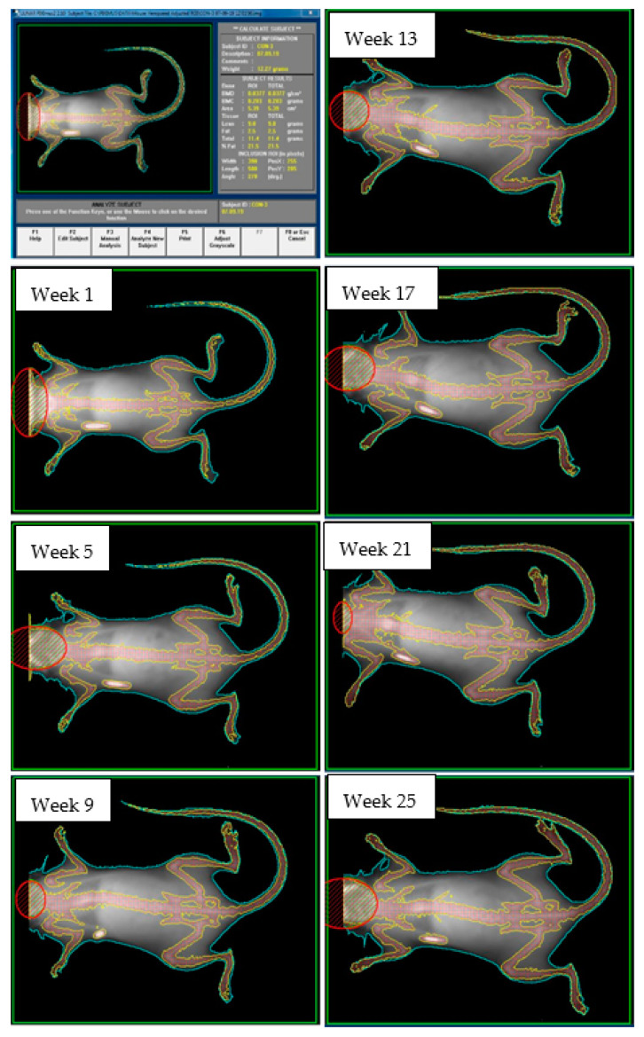 Representative time series of dual-energy X-ray absorptiometry images from one mouse (control group). Live mice were anesthetized and placed in the prone position for imaging. The skull was excluded from analysis. The white oval below the right forearm is an implanted identification microchip.